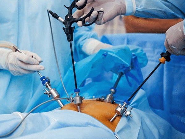 Laparoscopic surgery for all urological conditions