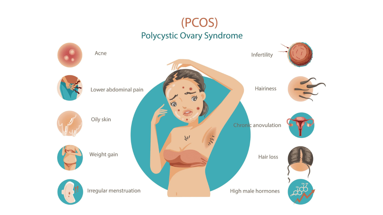 Best PCOD & PCOS Treatment in Mohali – Symptoms, Causes & Advanced Care