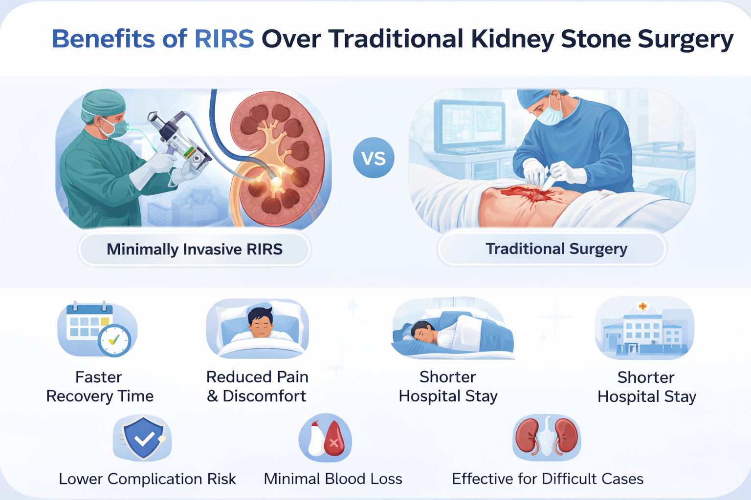 Benefits of RIRS Over Traditional Kidney Stone Surgery