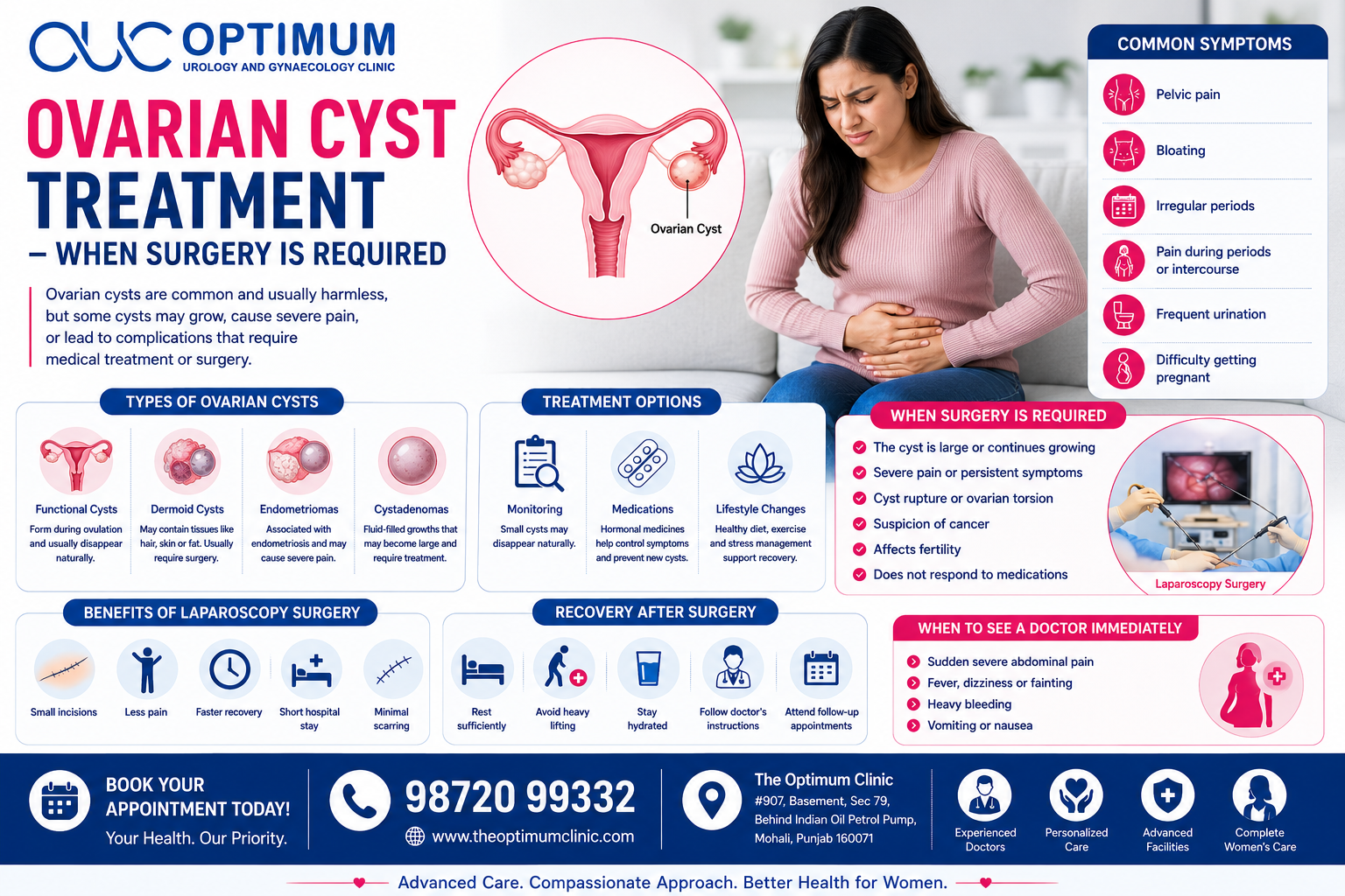 Ovarian Cyst Treatment – When Surgery is Required